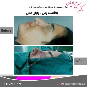 جراحی بینی شیراز 7