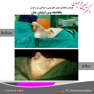 جراحی بینی شیراز 9