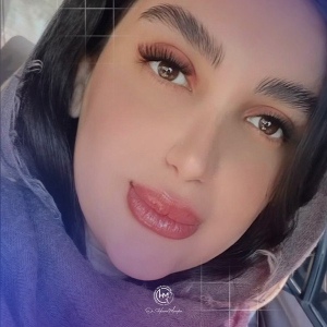 1_rhinoplasty-206