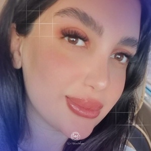 1_rhinoplasty-207