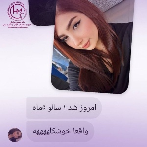2_rhinoplasty-219