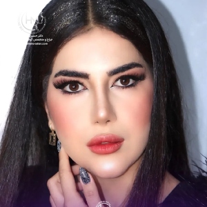 rhinoplasty-151