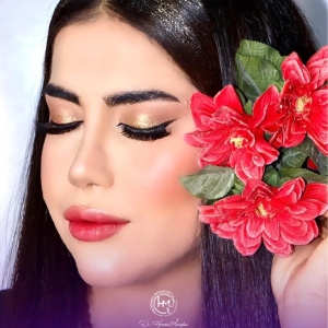 rhinoplasty-152