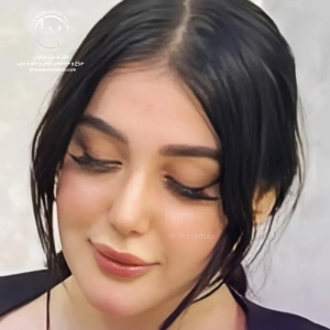 rhinoplasty-157