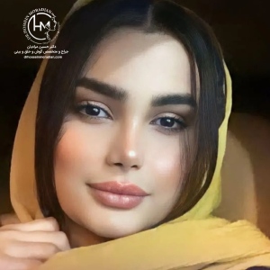 rhinoplasty-175-1