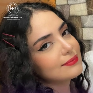 rhinoplasty-180