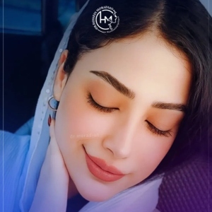 rhinoplasty-186