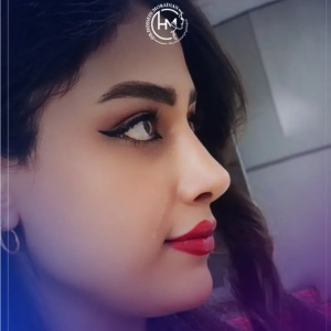 rhinoplasty-188