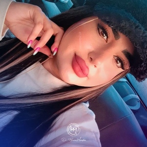rhinoplasty-212