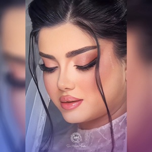 rhinoplasty-214