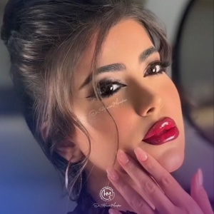 rhinoplasty-216