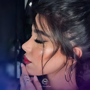 rhinoplasty-219