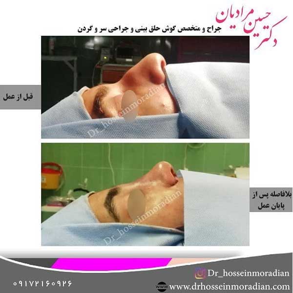 جراح بینی شیراز