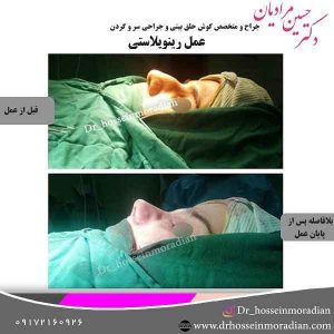 بهترین جراح بینی شیراز