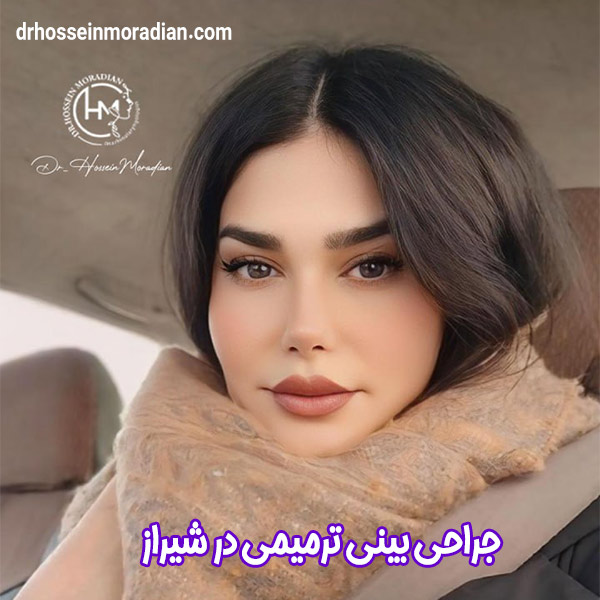 جراحی بینی ترمیمی در شیراز - دکتر حسین مرادیان 