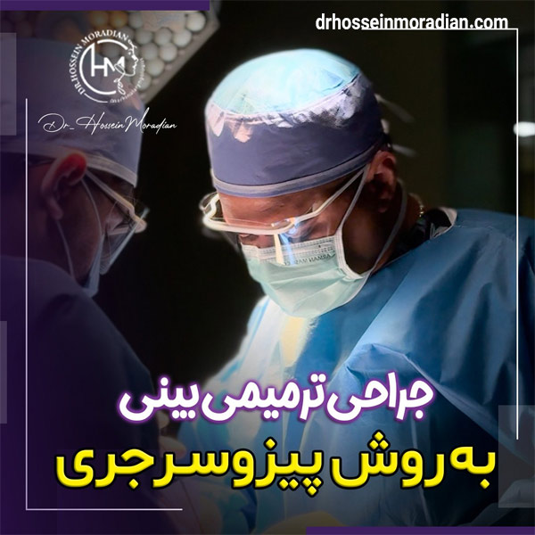 بهترین جراح بینی ترمیمی شیراز - دکتر حسین مرادیان
