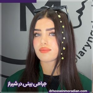 جراحی بینی در شیراز - دکتر حسین مرادیان