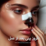 نکروز بینی بعد از عمل - دکتر حسین مرادیان