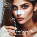 اصلاح صورت بعد از عمل بینی - دکتر حسین مرادیان