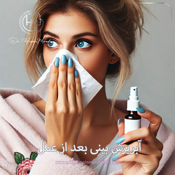 آبریزش بینی بعد از عمل - دکتر مرادیان
