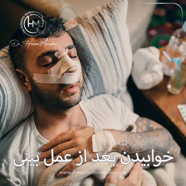 نحوه صحیح خوابیدن بعد از عمل بینی - دکتر مرادیان