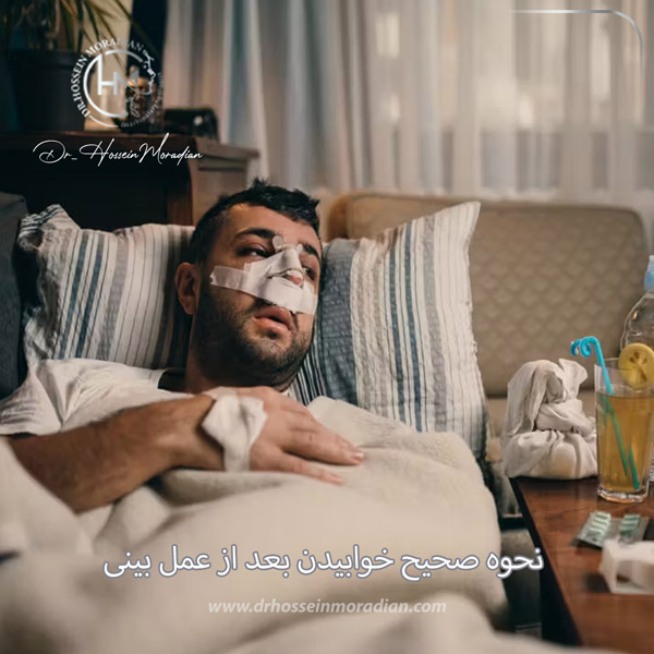 خوابیدن بعد از عمل بینی - دکتر حسین مرادیان
