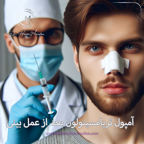 آمپول تریامسینولون بعد از عمل بینی - دکتر حسین مرادیان