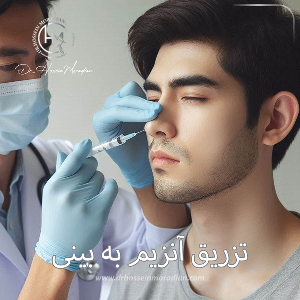 تزریق آنزیم به بینی - دکتر حسین مرادیان