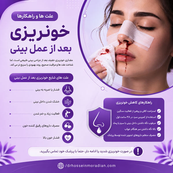 خونریزی بعد از عمل بینی - دکتر مرادیان