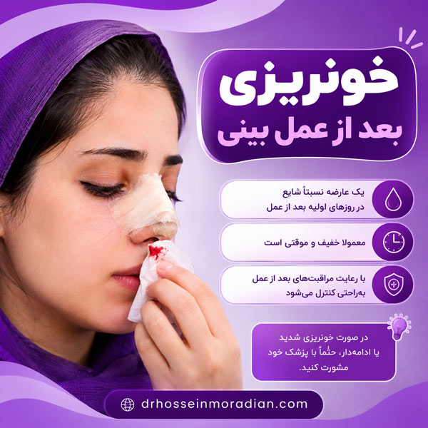 خونریزی بعد از عمل بینی - دکتر مرادیان