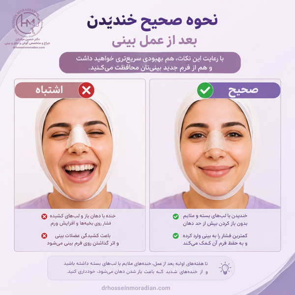 نحوه صحیح خندیدن بعد از عمل بینی - دکتر مرادیان