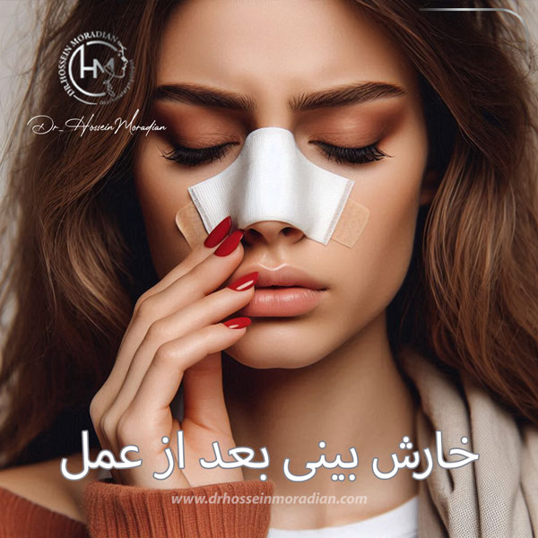 خارش بینی بعد از عمل - دکتر حسین مرادیان