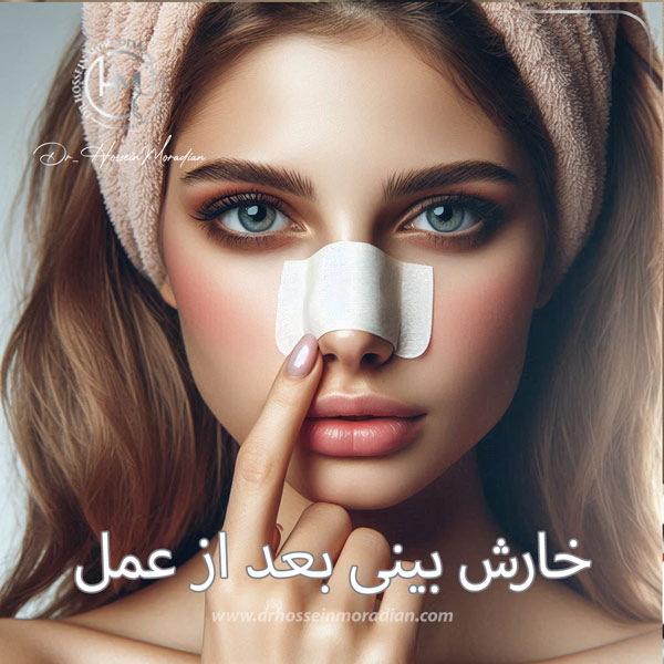 خارش بینی بعد از عمل - دکتر حسین مرادیان