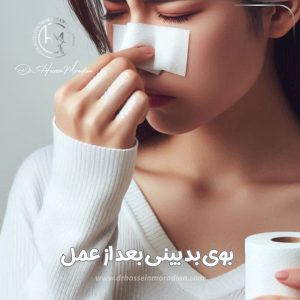 بوی بد بینی بعد از عمل - دکتر حسین مرادیان