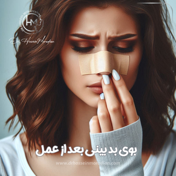 بوی بد بینی بعد از عمل - دکتر حسین مرادیان