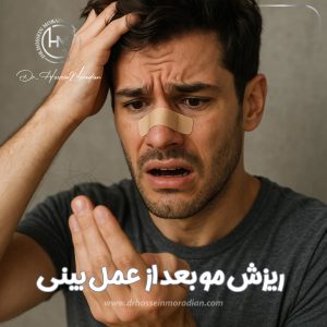 ریزش مو بعد از عمل بینی - دکتر حسین مرادیان