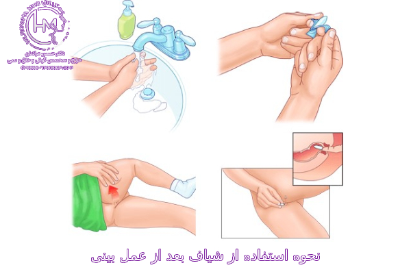 نحوه مصرف شیاف دیکلوفناک بعد از عمل بینی - دکتر حسین مرادیان