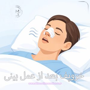 خروپف بعد از عمل بینی- دکتر مرادیان