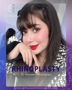 نمونه کار دکتر حسین مرادیان